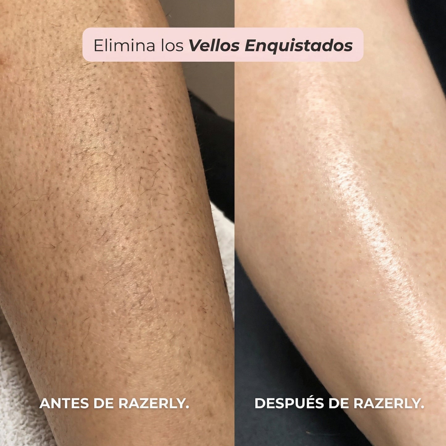 Maquinilla 2 en 1 para Bikini y Cuerpo ™
