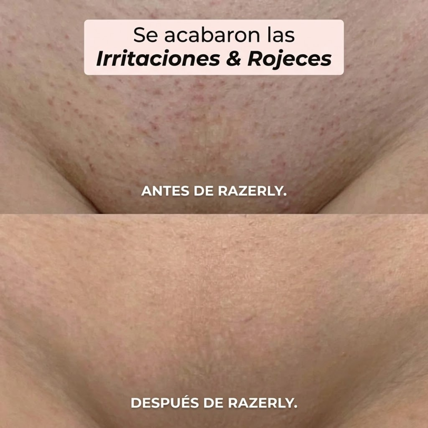 Maquinilla 2 en 1 para Bikini y Cuerpo ™